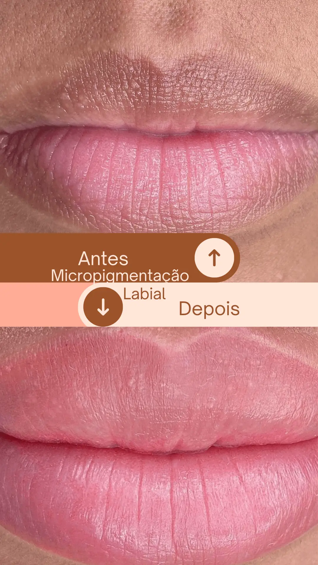 Conquiste lábios definidos e com cor duradoura. Agende sua sessão de micropigmentação labial!